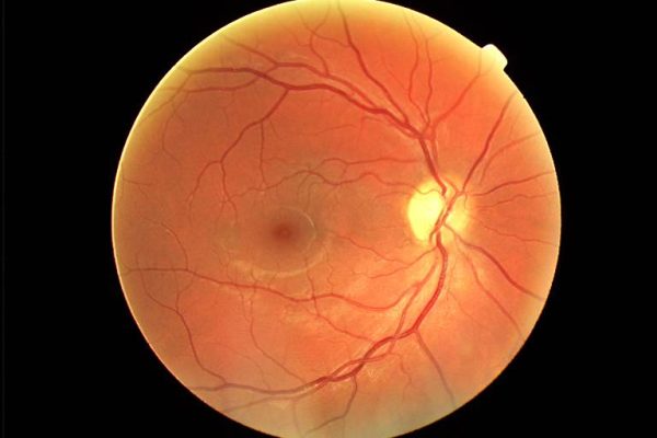 7010,"Blacknell",2001-04-29,12:03:05,Color,@0,,0,3,1,1,103,3,45.0,0.38712,FFFF2A9D:00000000